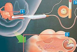 上海试管医院最新排名揭秘